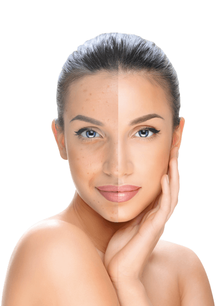 piperina-woman-1-2.png piperina-woman-1-2.png